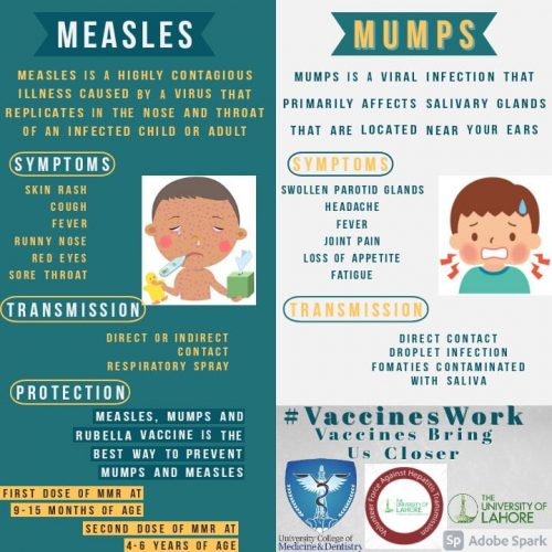 Measles and Mumps